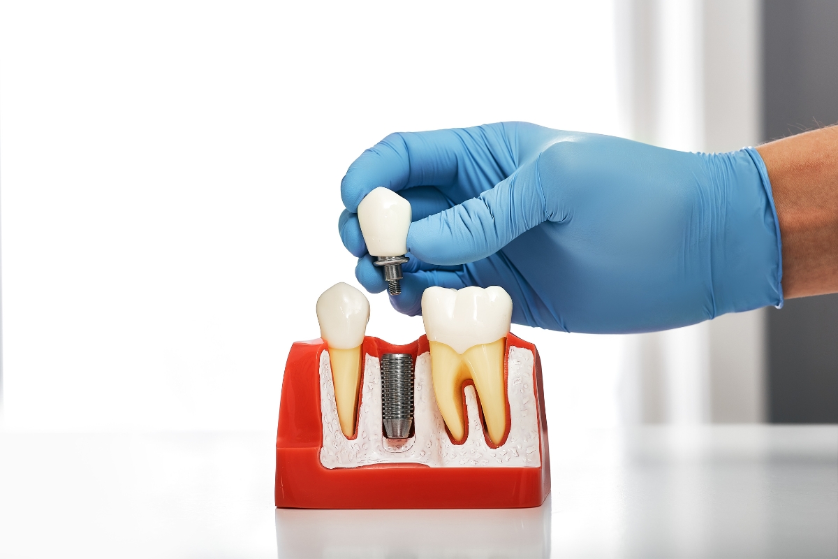 local dental care and dental implants how jupiter practices ensure safety and comfort