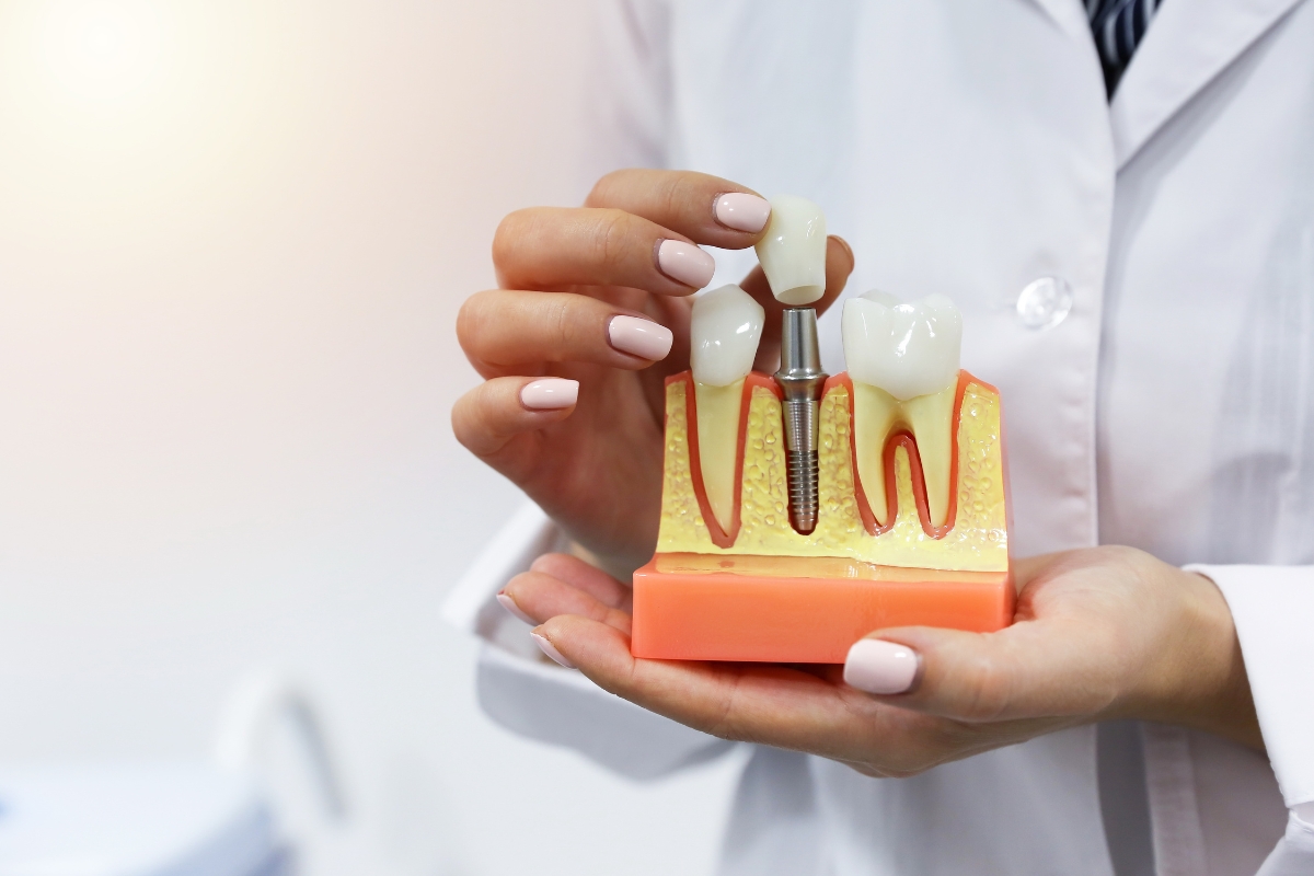 post-implant care how wellington dentists can help you heal faster
