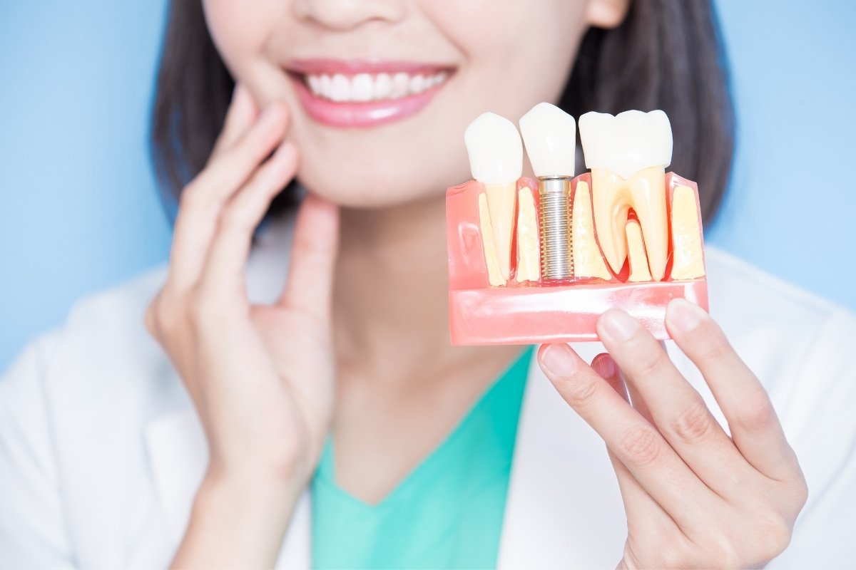 the connection between dental implants and jawbone health